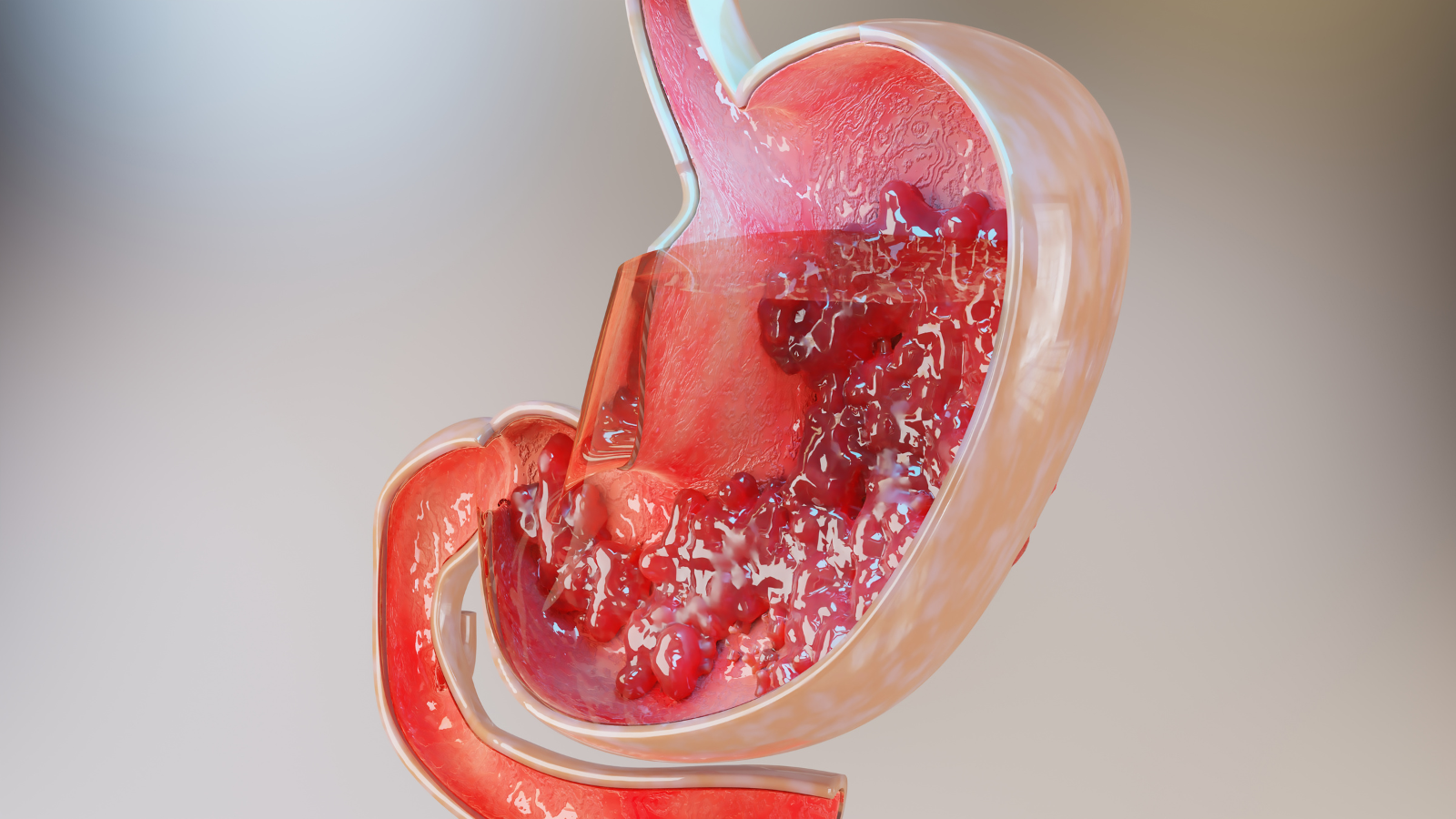 Why Should You Consider Trying Plant-Based Digestive Enzymes?